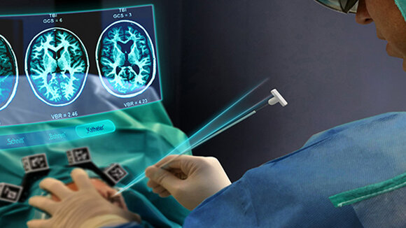 UID gewinnt mit Augmented-Reality-App für Gehirnchirurgen einen UX Design Award 2020